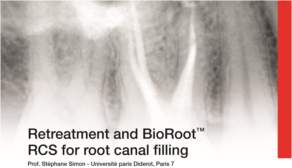 CSC16_Retreatment and BioRoot™ RCS for root canal filling