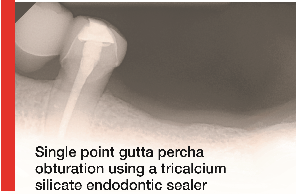 CSC16_Single point gutta percha obturation using a tricalcium silicate endodontic sealer
