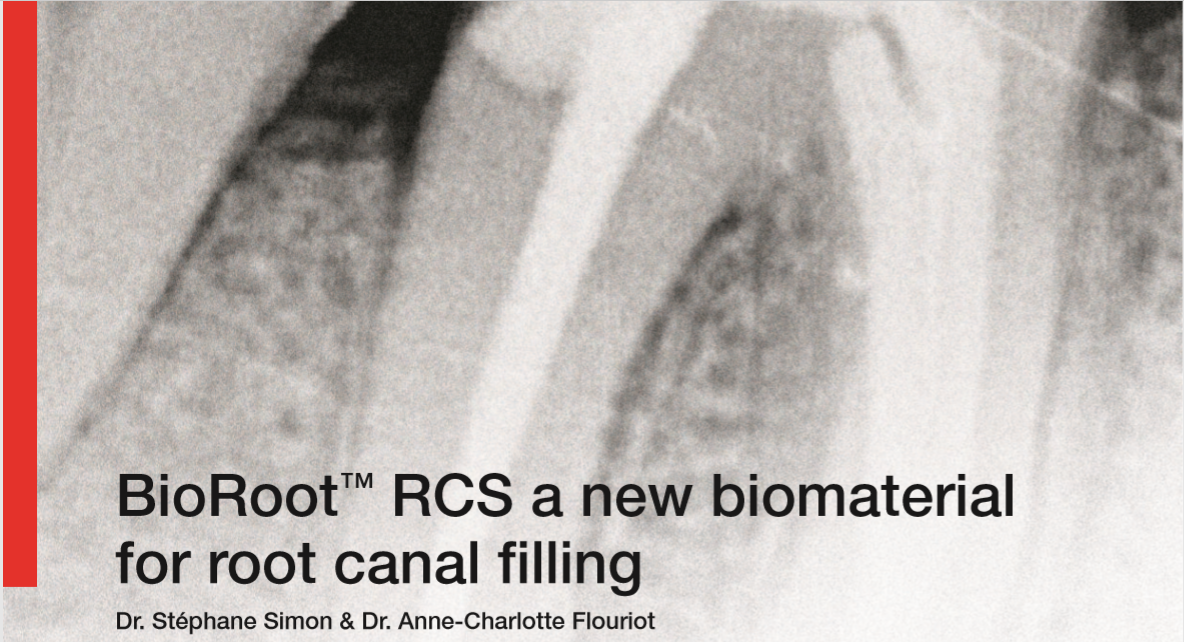 CSC13_BioRoot™ RCS a new biomaterial for root canal filling