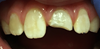 Waarom is het zo belangrijk voor tandartsen om de pulpa bij tanden van kinderen te behouden? 4