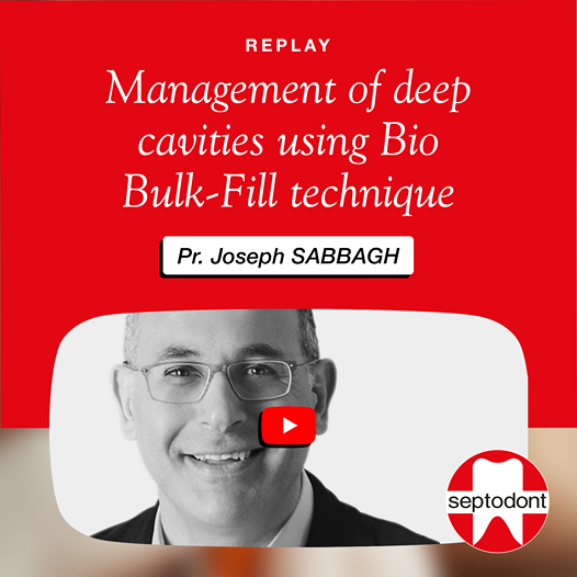 Replay webinar prof. Sabbagh: management of deep cavities using bio bulk fill technique