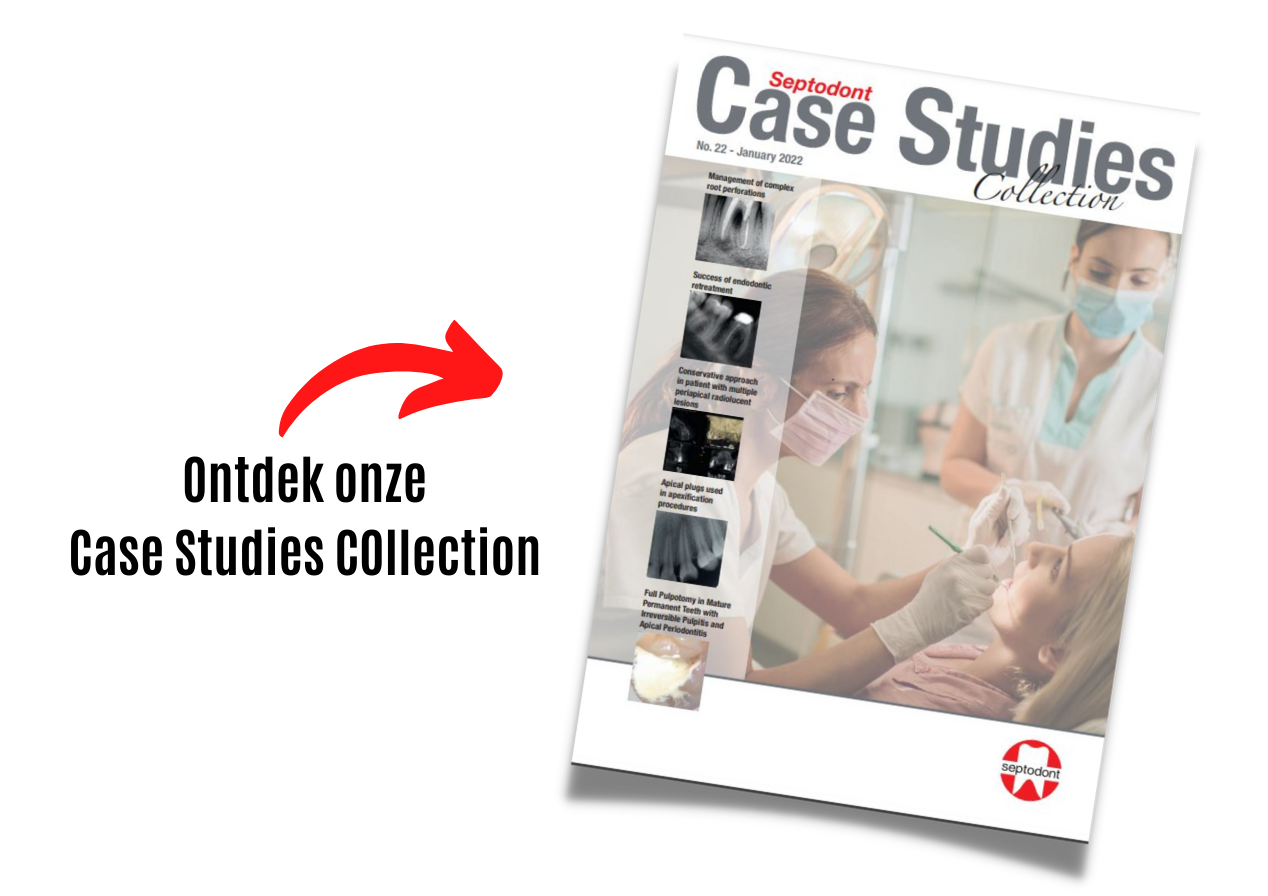 Case Studie Collection n°22 aankondiging 