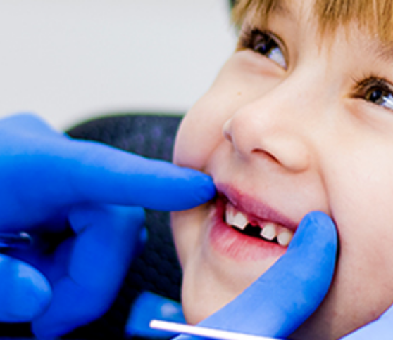 lachende mond kind bij tandarts - omgaan met pijn bij patiënt