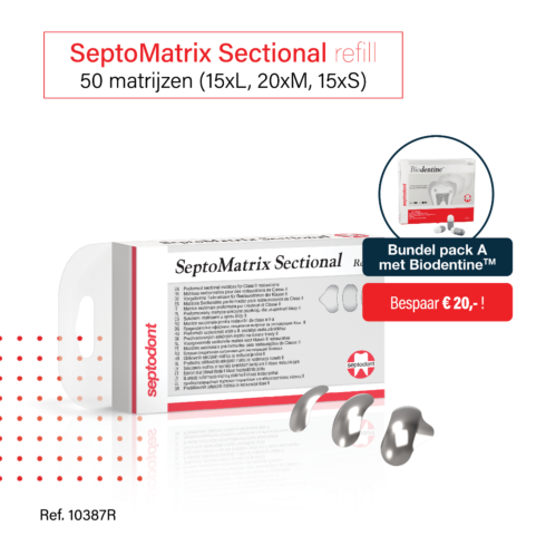 SeptoMatrix Sectional, promo februari 2023