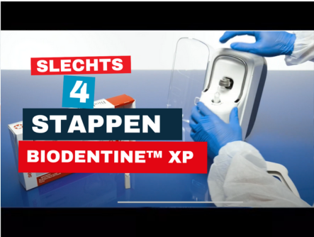https://www.septodont-nl.be/media/catalog/product/s/l/slechts_4_stappen_thumbnail_youtube_01112024.png