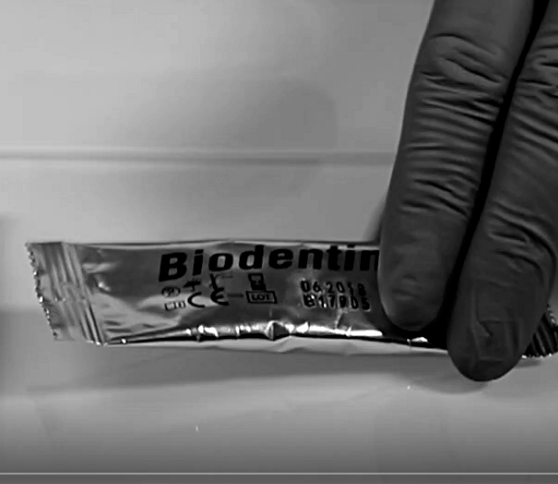 Biodentine⢠induces TGF-β1 release from human pulp cells and early dental pulp mineralization